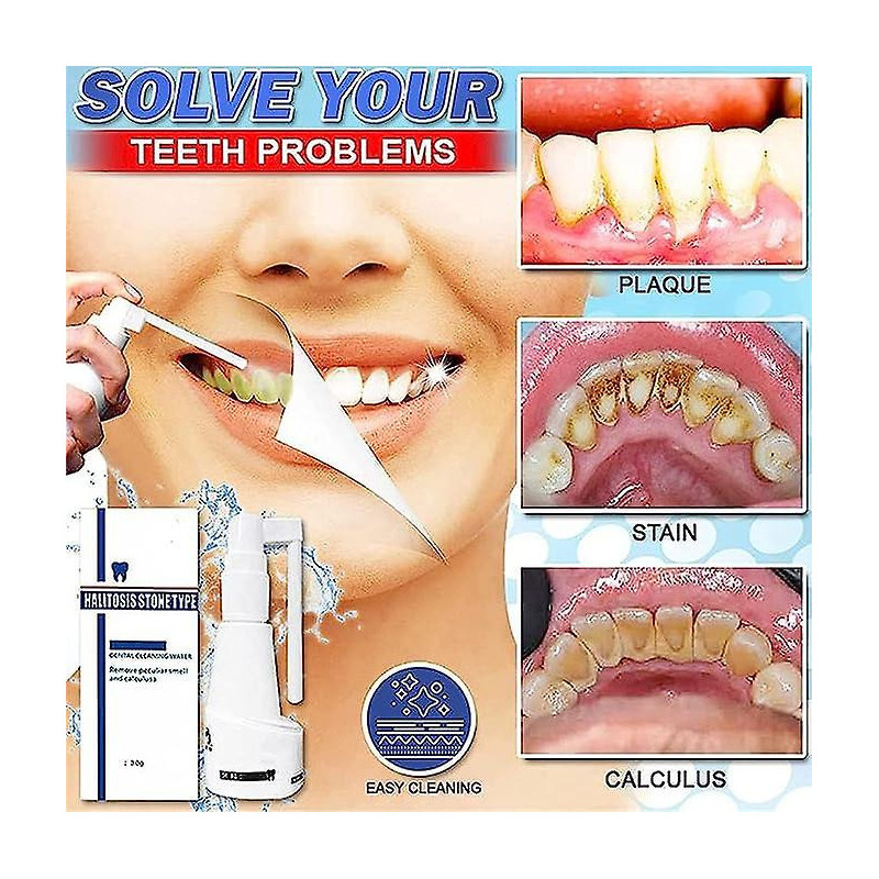 30ml Spray dentaire dissolvant sans calcul, nettoyant dentaire pour dents décapantes, spray rafraîchissant pour la [...]