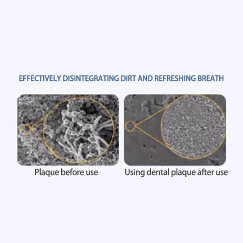 Clean Up Stains, Bad Breath, Fresh Breath Spray 30ml, Oral Care Multi-effect Cleaning Agent To Clean Teeth