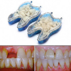 Kit dentaire temporaire pour remplacer les dents manquantes en quelques minutes-mxbc Kit dentaire temporaire pour remplacer les dents manquantes en quelques minutes-mxbc