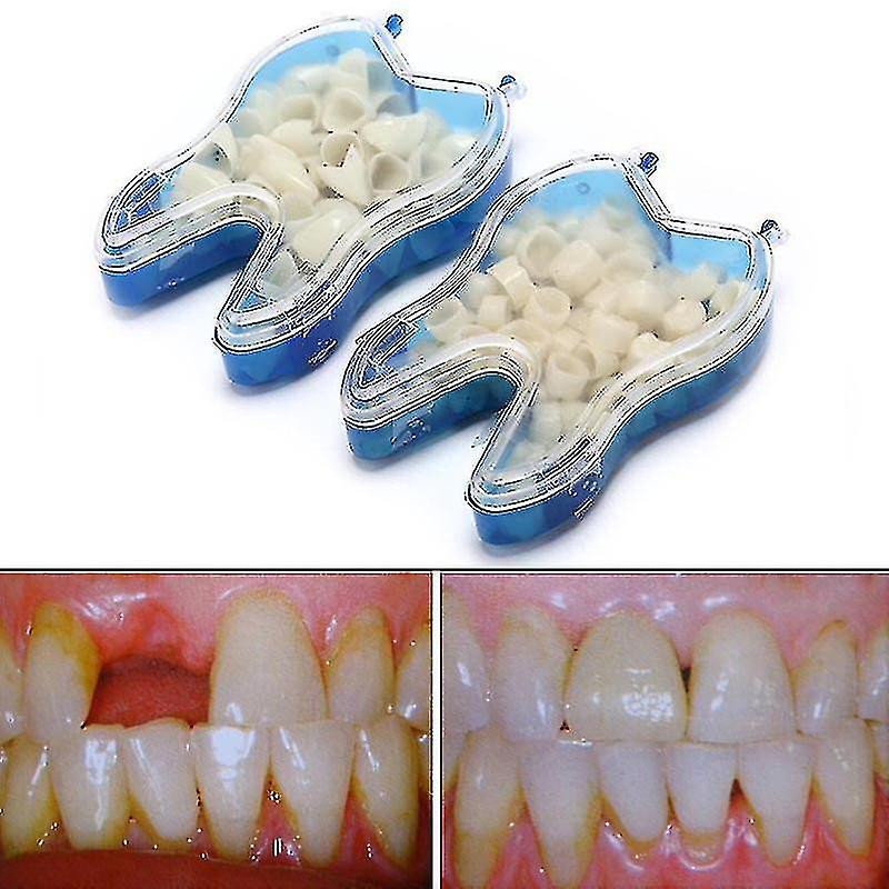 Kit dentaire temporaire pour remplacer les dents manquantes en quelques minutes-mxbc