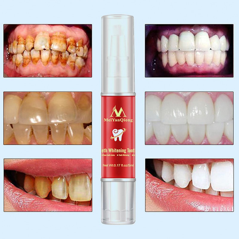 Teeth Whitening Brush Plaque Stains Remover Cleaning Dental Oral Hygiene Care