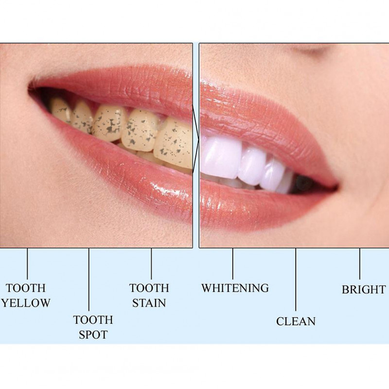 Teeth Whitening Brush Plaque Stains Remover Cleaning Dental Oral Hygiene Care