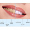 Teeth Whitening Brush Plaque Stains Remover Cleaning Dental Oral Hygiene Care
