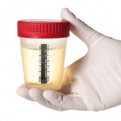 25pcs Urine Temperature Strips Travel Bottle Temperature Stickers 32-38 Centigrade/90-100 Fahrenheit