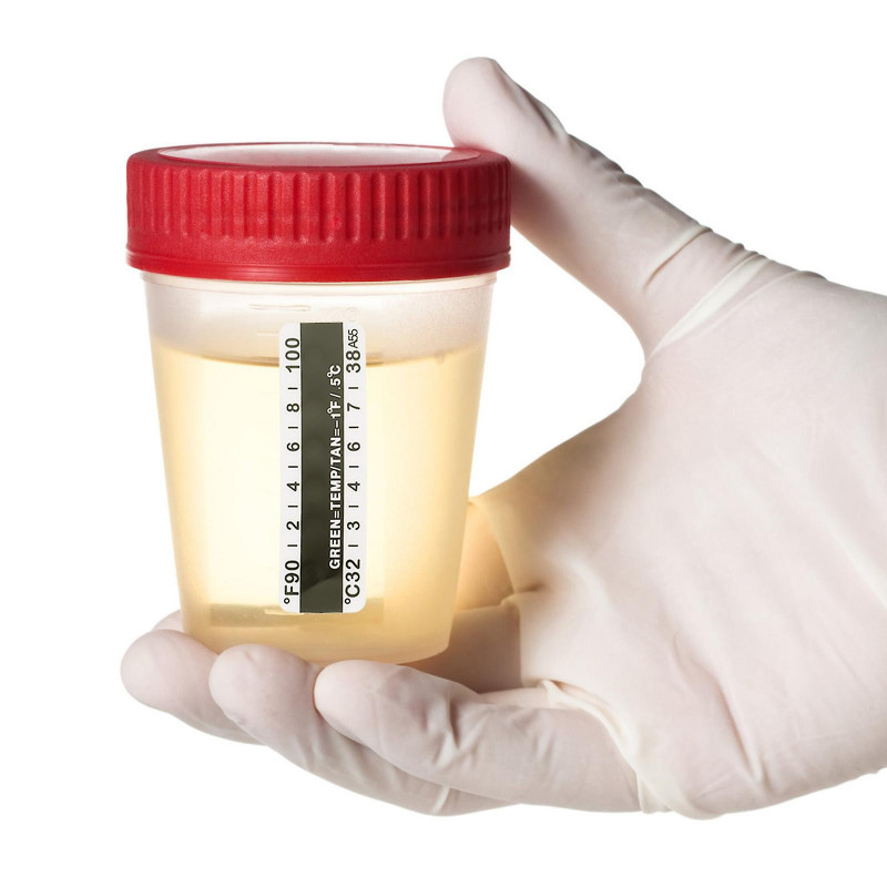 25pcs Urine Temperature Strips Travel Bottle Temperature Stickers 32-38 Centigrade/90-100 Fahrenheit