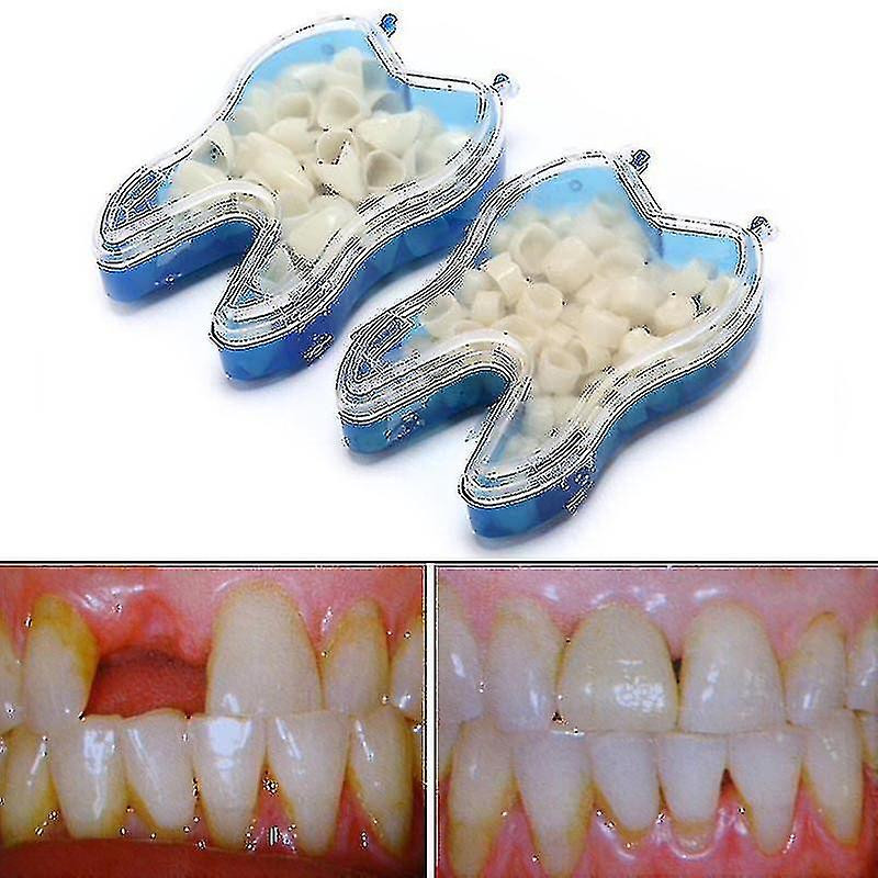 Kit dentaire temporaire pour remplacer les dents manquantes en quelques minutes