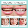 Whitening Moussed Toothpaste Teeth Yellowing To Bad Breath Teeth Whitening Portable Foam Toothpaste Oral Cleaning [...]