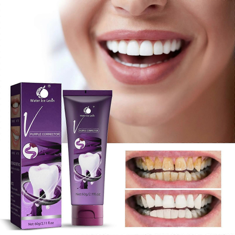 Whitening Teeth Cleaning Oral Cavity Refreshing And Removing Calculus Toothpaste 60g Cosmetic Sets FLY2495