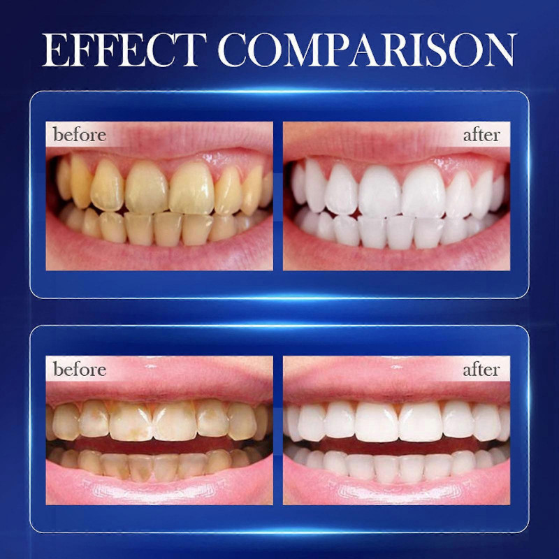 Dazzling White Fresh Baking Sodas Toothpaste Clean Teeth Clean Toothpaste Cosmetic Sets FLY2459