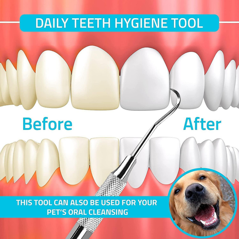 Tartar Scr Tool - Éliminateur de tartre à double extrémité pour les dents (paquet de 2)