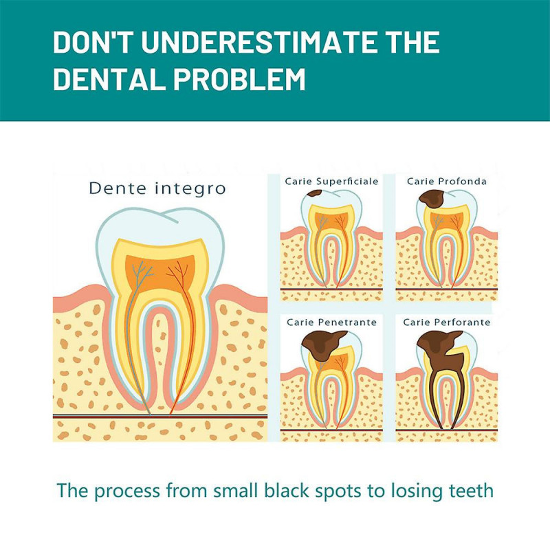 1-3x Dentifrice Mousse De Blanchiment Des Dents Nettoyage En Profondeur Plaque Taches Réparation Éclaircissant [...]