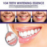 3pcs V34 Violet Dents Nettoyage Stylo dentifrice Sérum Plaque Élimination Taches Jaunes Tartre Blanchiment [...]