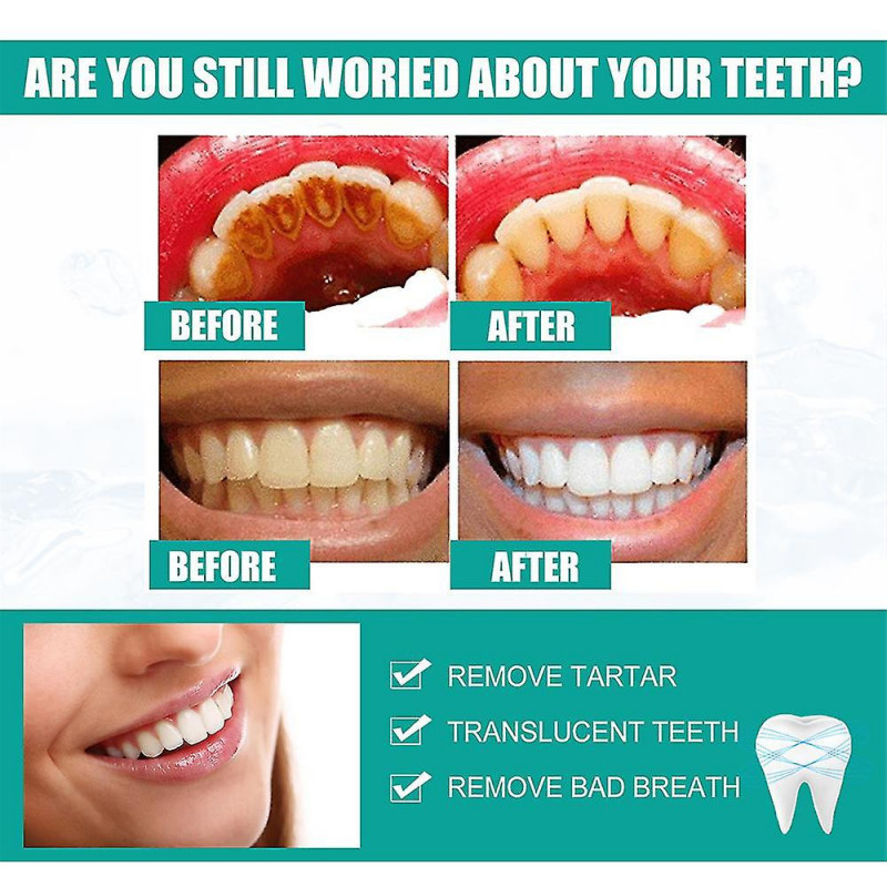 Dentifrice Dentifrice Poudre Dentaire Enlever Plaque Jaune Nettoyage Taches De Café Éclaircir Thé Tache Fraîche [...]