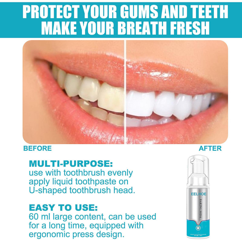 Blanchiment des dents Hygiène bucco-dentaire Blanchiment des dents Mousse de blanchiment des dents Dentifrice [...]