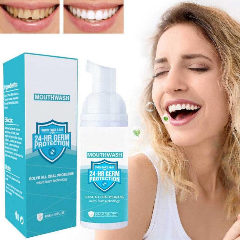 Teethaid Mousse de blanchiment des dents Mousse détartrant des dents Nettoyage des dents Mousse de soin nettoyante [...]