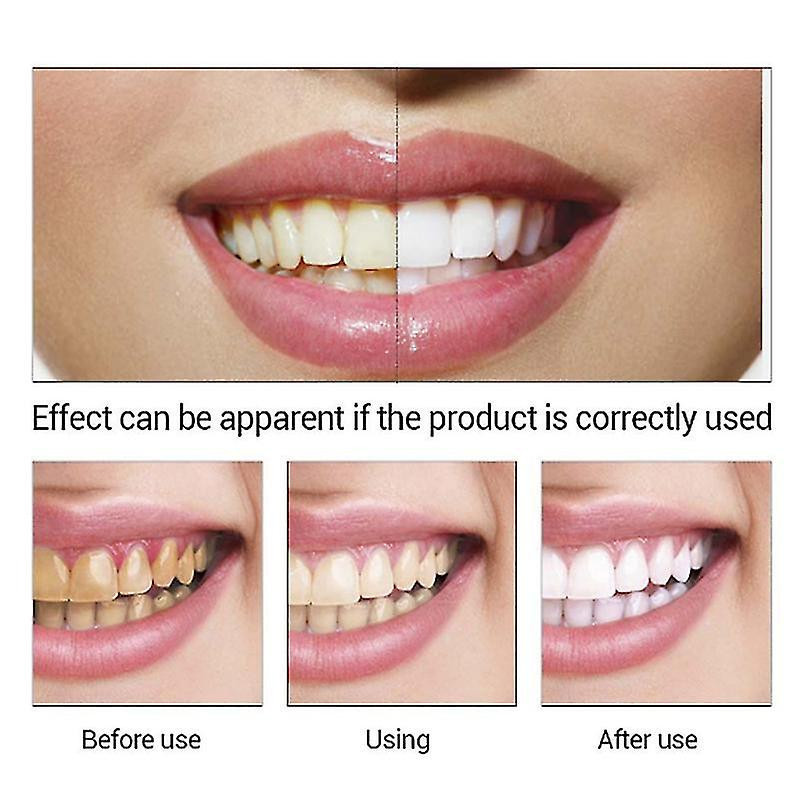 Teeth Whitening Essence Remove Smoke Coffee Plaque Stains Cleaning Oral Hygiene Gel Fresh Breath Bleaching Dental [...]