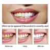 Teeth Whitening Essence Remove Smoke Coffee Plaque Stains Cleaning Oral Hygiene Gel Fresh Breath Bleaching Dental [...]