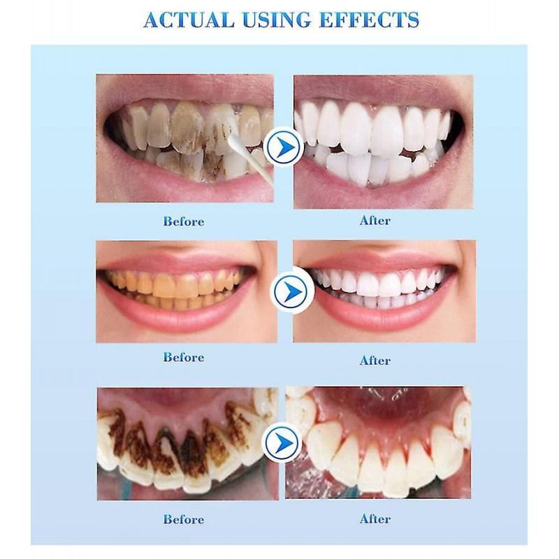 Teeth Whitening Essence Remove Smoke Coffee Plaque Stains Cleaning Oral Hygiene Gel Fresh Breath Bleaching Dental [...]