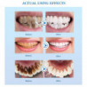 Teeth Whitening Essence Remove Smoke Coffee Plaque Stains Cleaning Oral Hygiene Gel Fresh Breath Bleaching Dental [...]