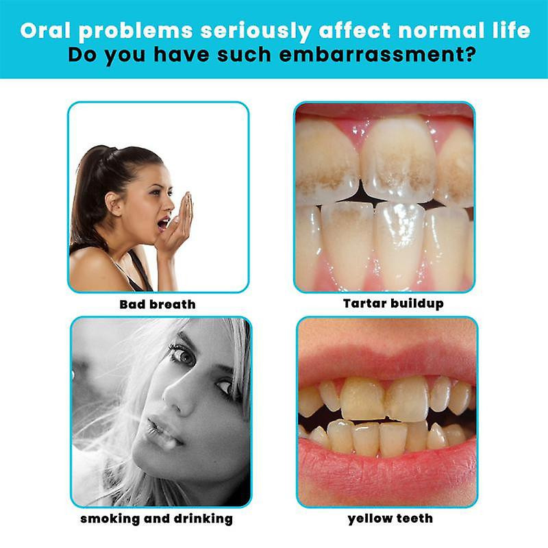 50ml Mousse Toothpaste Mint Oral Cleansing Tooth Fresh Tone Anti-decay Tooth Stain Removal Whitening Foam Oral [...]