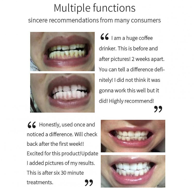 50ML Teeth Cleaning Mousse Refreshing Breath Teeth Brightening Toothpaste