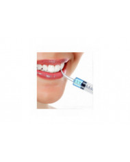 10pcs 12ml Disposable Dental Syringe Transparent Elbow Syringe Teeth Washing Tool Dental Irrigation Liquid [...]