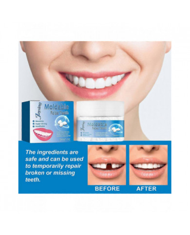 Dents Fortes Réparation Dentaire Ciment Dentaire Permanent Caries Remplissage Kit Fausses Dents