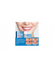 Dents Fortes Réparation Dentaire Ciment Dentaire Permanent Caries Remplissage Kit Fausses Dents