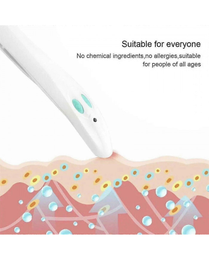 Away - Stitch Healer - Le stylo chauffant électronique soulage les démangeaisons sans produits chimiques