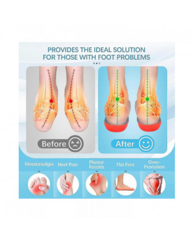 2 paires de semelles Norélie, semelles orthopédiques Norelie pour le soutien de la voûte plantaire, semelles [...]
