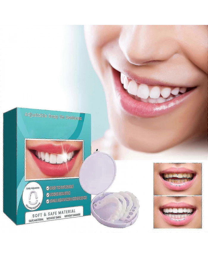 Dents de prothèse dentaire De fausses dents temporaires pour un sourire de confiance instantané, facettes [...]