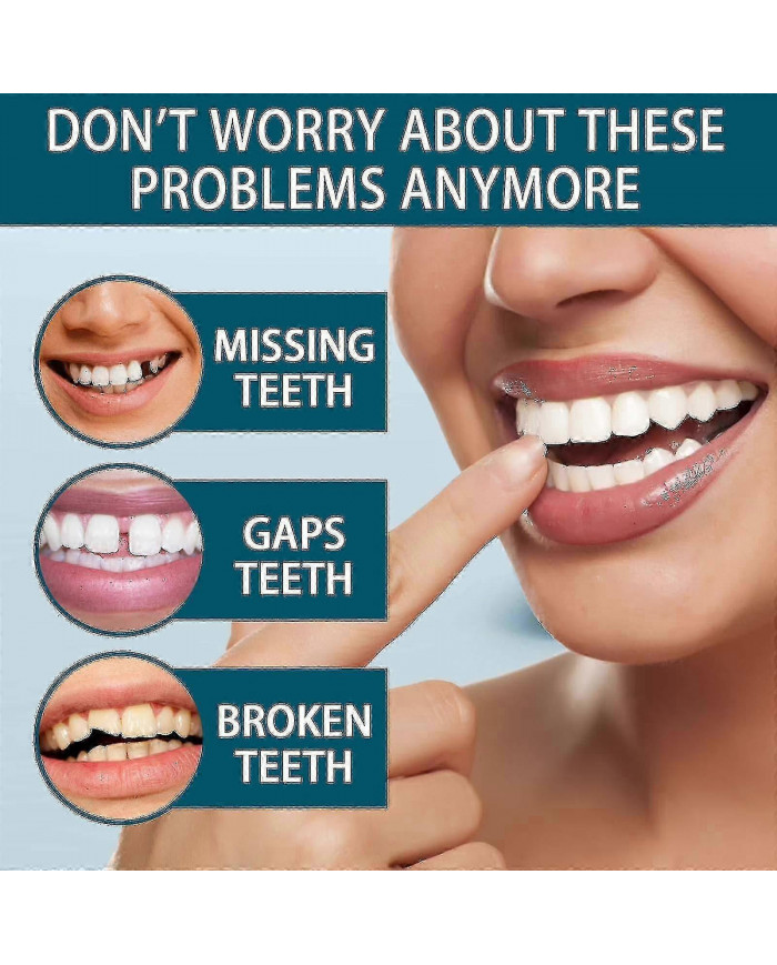 Dents de prothèse dentaire De fausses dents temporaires pour un sourire de confiance instantané, facettes [...]