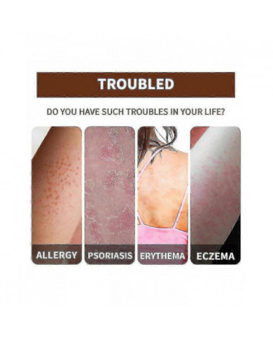 Huile essentielle de réparation du psoriasis - Soulagement de l’enflure anti-démangeaisons pour la main, le pied [...]