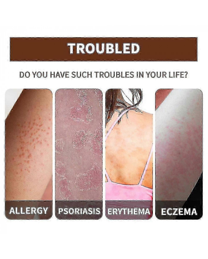 Huile essentielle de réparation du psoriasis - Soulagement de l’enflure anti-démangeaisons pour la main, le pied [...]