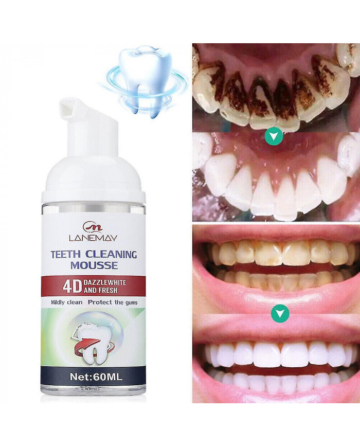 Menthe Dents Blanchiment Dentifrice Mousse Bicarbonate de Soude Pâte Mousse Tache Enlever