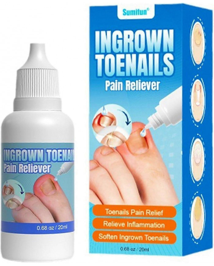 Traitement des ongles incarnés extra fort,Chute des ongles incarnés,Huile de soin des cuticules pour les ongles [...]