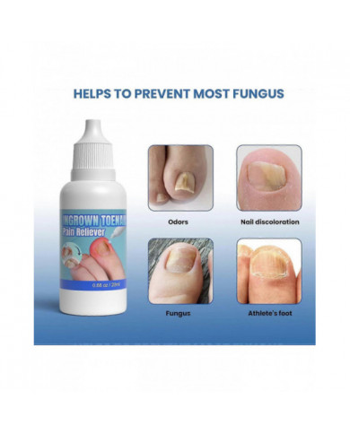 Traitement des ongles incarnés extra fort,Chute des ongles incarnés,Huile de soin des cuticules pour les ongles [...]