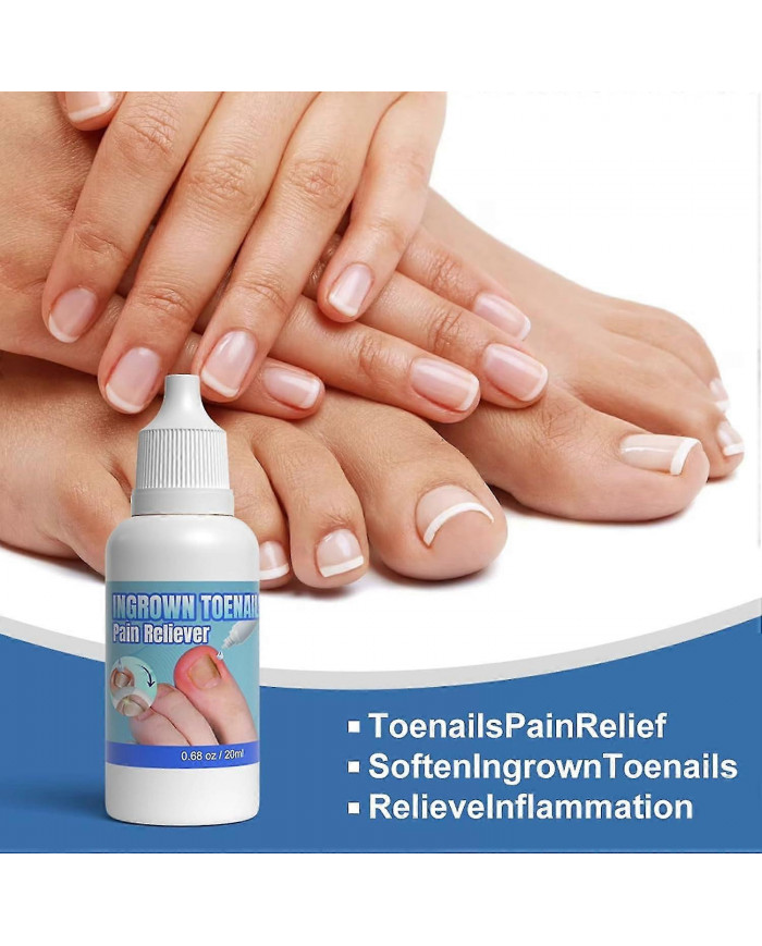 Traitement des ongles incarnés extra fort,Chute des ongles incarnés,Huile de soin des cuticules pour les ongles [...]