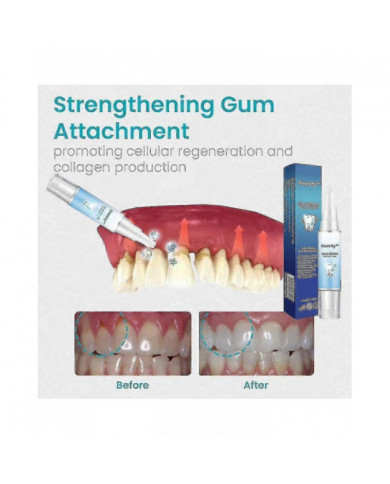 Gel réparateur des gencives Reconstruire renforcer blanchir éliminer l’inflammation de l’haleine Dent buccale [...]