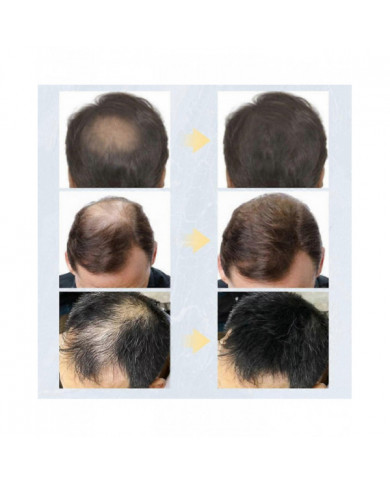 Kératine Fibres Capillaires Sujet Spray Applicateur 27.5g Poudre Colorée Pour La Perte De Cheveux Beauté Bâtiment [...]