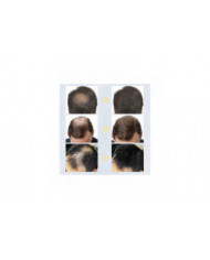 Kératine Fibres Capillaires Sujet Spray Applicateur 27.5g Poudre Colorée Pour La Perte De Cheveux Beauté Bâtiment [...]