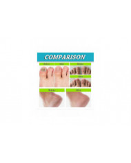 3pcs Foot And Nail Spary, Soins des pieds naturels et puissants