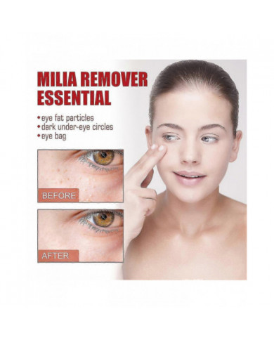 Milia Remover Essential Eye Serum Efficace Élimine les granules de graisse Poches sous les yeux Anti-particules Poches