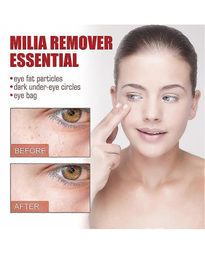 Milia Remover Essential Eye Serum Efficace Élimine les granules de graisse Poches sous les yeux Anti-particules Poches