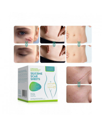 Huidverzorging Voor Het Gezicht Silicone Scar Patch, Silicone Scar Tape Roll, Silicone Scar Strip, Reusable Scar [...]