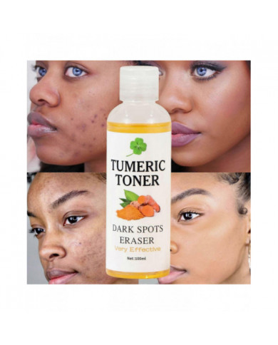 Toner Taches Sombres Gomme Curcuma Toner Eau Blanchiment Peau Blanchiment Peau 100ml