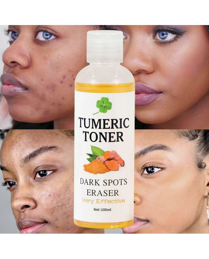 Toner Taches Sombres Gomme Curcuma Toner Eau Blanchiment Peau Blanchiment Peau 100ml