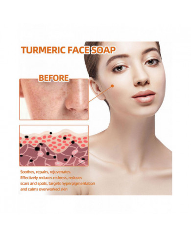 Savon nettoyant au curcuma Savon nettoyant exfoliant anti-âge naturel pour éclaircir les taches, effacer les [...]