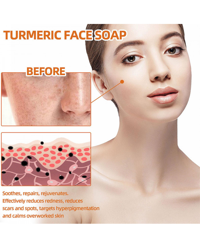 Savon nettoyant au curcuma Savon nettoyant exfoliant anti-âge naturel pour éclaircir les taches, effacer les [...]