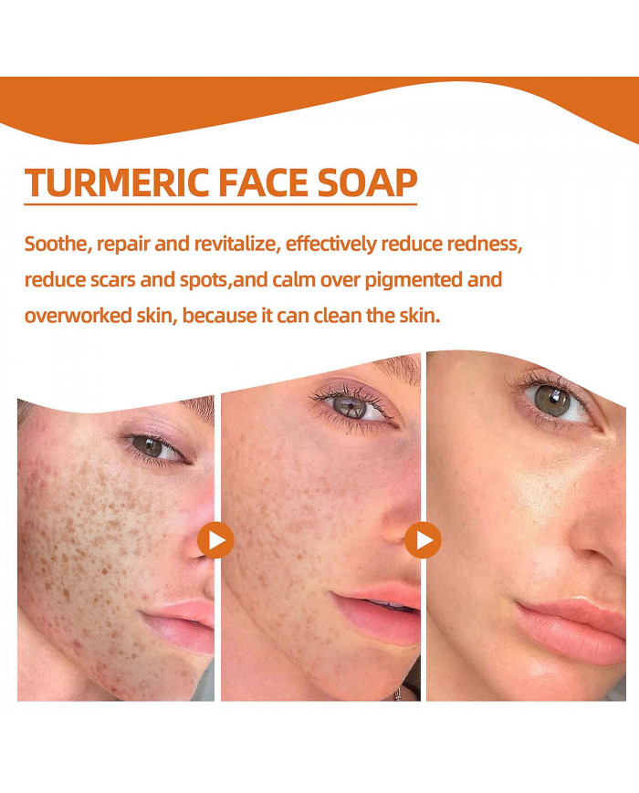 Savon nettoyant au curcuma Savon nettoyant exfoliant anti-âge naturel pour éclaircir les taches, effacer les [...]